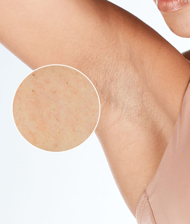 Po 3 o&scaron;etreniach