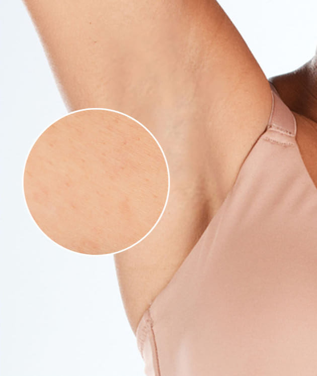 Po v&scaron;etk&yacute;ch o&scaron;etreniach