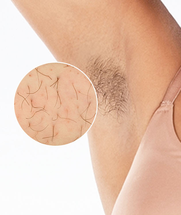 Pred o&scaron;etren&iacute;m