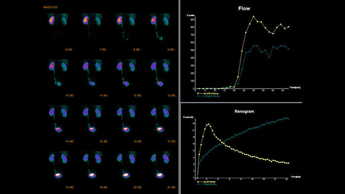 processing application suite thumbnail