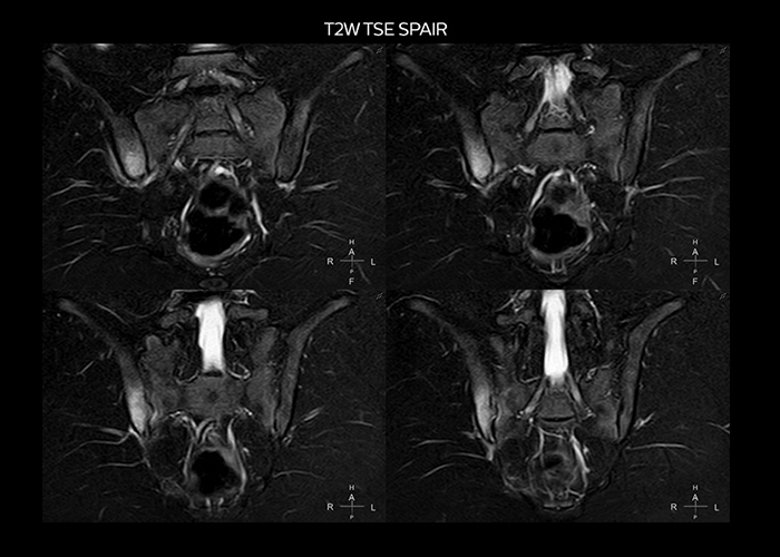 clinical cases tab2 image2
