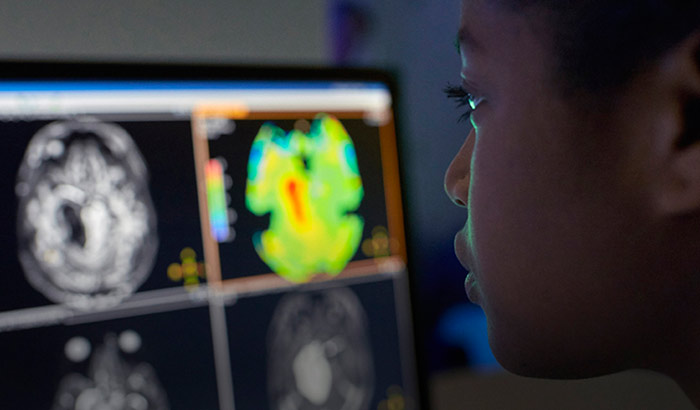 apt brain tumor mri home 700 375