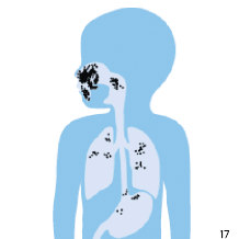 Maska, ktor&aacute; dobre neprilieha
