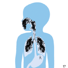 Maska, ktor&aacute; spr&aacute;vne prilieha