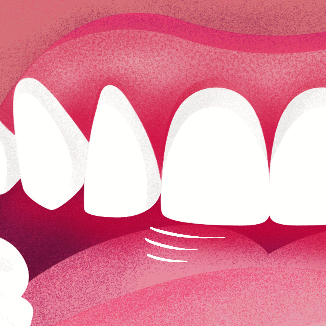 Kart&aacute;čkov&eacute; hlavice vyměňte každ&eacute; 3&nbsp;měs&iacute;ce, ikona