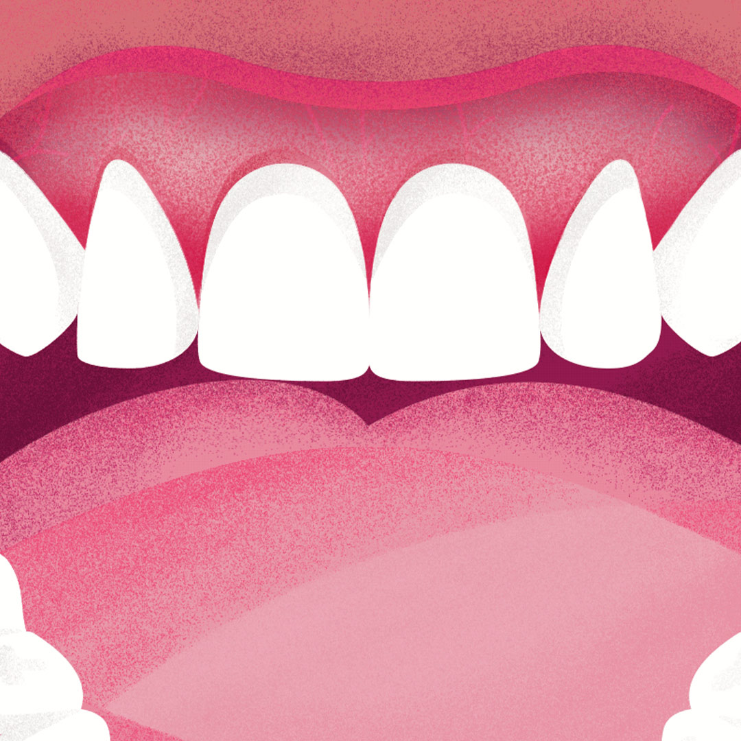 Kart&aacute;čkov&eacute; hlavice vyměňte každ&eacute; 3&nbsp;měs&iacute;ce, ikona