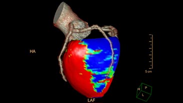 ct comprehensive cardiac analysis